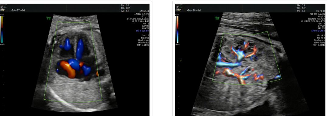 Các loại máy siêu âm chất lượng tốt nhất hiện nay là gì?